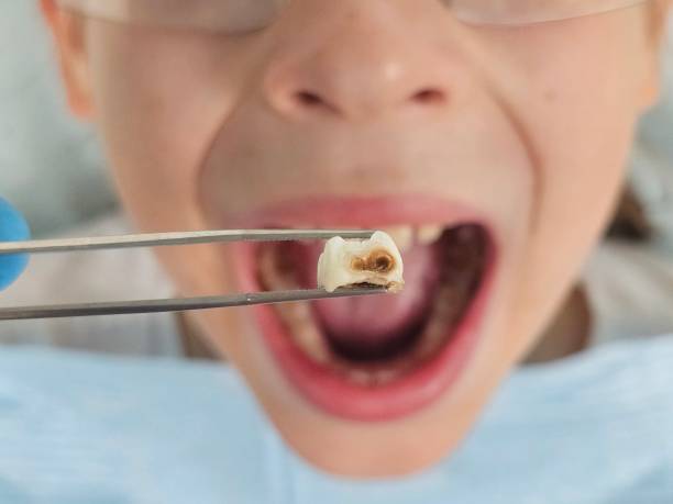 Best Pediatric Emergency Dentist in Flordell Hills, MO